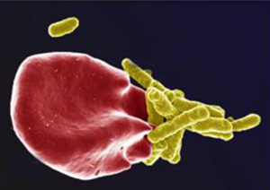Foton på mikrober i blodet: Marnie Potgieter, Janette Bester, Douglas B. Kell and Etheresia Pretorius