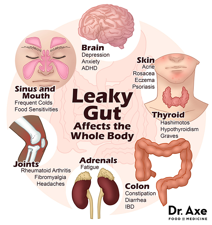 Leaky Gut Syndrome - Image: Draxe.com