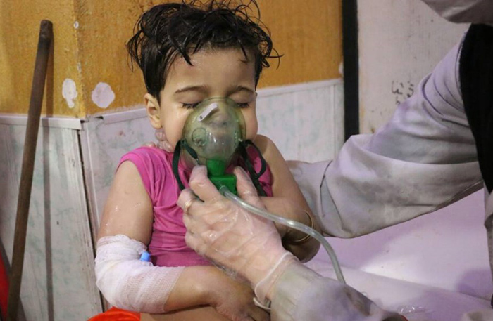 Barn drabbat av påstådd kemisk attack i Douma, Syrien - Fotograf okänd