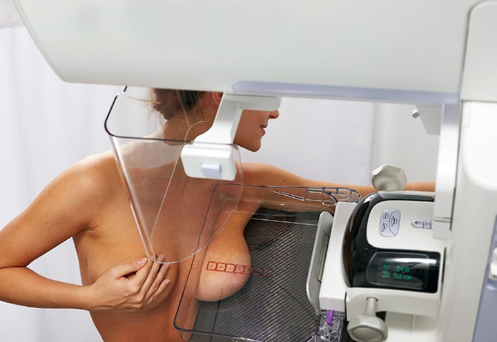 Mammografi - Källa: Wikied.ru